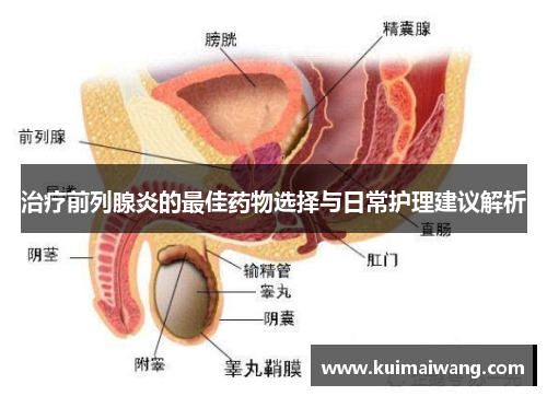 治疗前列腺炎的最佳药物选择与日常护理建议解析